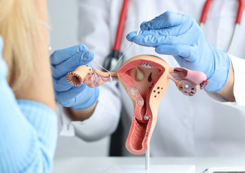 Expert Fertility Diagnosis